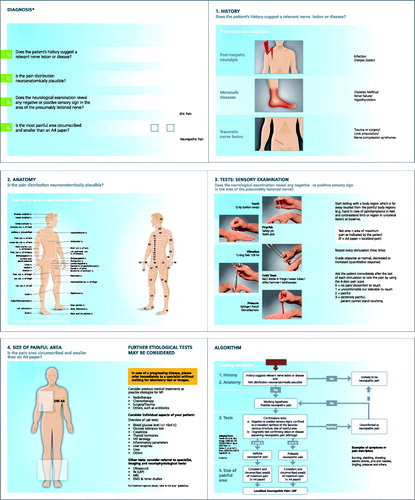 Figure 1. Screening tool for probable neuropathic pain and localized neuropathic pain; A6 pocket card (translation from Spanish to English including design adaptations from the study version). The tool consists of four screening questions plus information/examples regarding these questions, and a diagnosis algorithm.