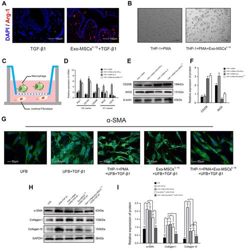 Figure 2 Exosomes from IL-1β-induced MSCs inhibit activation of urethral fibroblasts by regulating macrophage polarization in vitro. (A) Immunofluorescence microscopy images of Arg-1 expression in urethral tissues treated with TGF-β1 alone or TGF-β1 + Exo-MSCsIL−1β. (B) Light microscopy images showing the morphology of THP-1 cells incubated for 48 h with PMA in the presence or absence of Exo-MSCsIL−1β. (C) Schematic of the Transwell co-culture system used in this study. (D) qRT-PCR analysis of mRNA levels of the indicated macrophage markers in UFBs co-cultured with the indicated cells and/or factors. (E and F) Western blot analysis (E) and quantification of band densities (F) of the indicated macrophage markers in UFBs co-cultured with the indicated cells and/or factors. (G) Immunofluorescence microscopy images of α-SMA expression in UFBs co-cultured with the indicated cells and/or factors. (H and I) Western blot analysis (H) and quantification of band densities (I) of α-SMA, collagen I, and collagen III in UFBs co-cultured with the indicated cells and/or factors. Data in (D, F and I) are presented as the mean ± SD of at least three independent experiments and were analyzed with Student’s t-test or one-way ANOVA (*P < 0.05; ns, not significant).