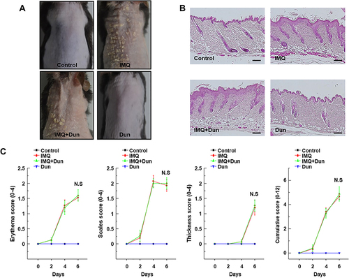 Figure 7 Effect of Dun on IMQ-induced dorsal skin inflammation in SIRT1−/− mice. Psoriasis was induced by topical application of IMQ. (A) Representative images of IMQ-induced psoriasis-like lesions in SIRT1−/− mice taken after 6 days of IMQ treatment. (B) Phenotypical presentation and corresponding histological analyses (H&E staining) of mouse dorsal skin. (C) Erythema, scaling, and thickness of dorsal skin scored on the indicated days from 0 to 6. The cumulative score (erythema plus scaling plus thickness) is depicted. Symbols indicate the mean ± S.D. (n = 5).