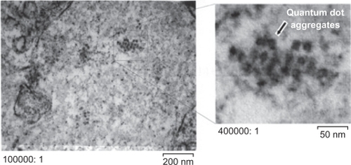 Figure 6 Electron micrographs of nasal mucosa one day after intranasal inoculation of amino-functionalized silica-shelled quantum dots (dissolved in distilled water, 30 drops per animal, single dose).Abbreviation: QD, quantum dot.