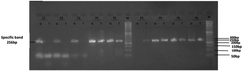 Figure 3. Gel electrophoresis (2%) for the PCR product of SOD1 rs17880135; Lane M indicates DNA marker (50 bp). Specific 256 bp bands illustrate G or T alleles; Lanes (C1, C2 and C3) represent GG homozygous genotyping where T allele absents in control group. Lane (P1, P2, P4, P5 and P6) represent GT heterozygous genotyping, where G and T alleles appear at 256 bp in cases group. Lane P3 represents TT homozygous genotyping where T allele appears in cases group.