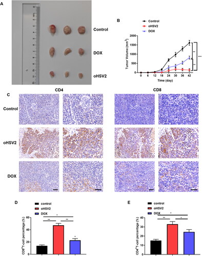 Figure 2. oHSV2 potently inhibits transplanted tumor growth and accelerates CD4 + T and CD8 + T cell infiltration in mice. (A) Representative images of DLBCL tumors after 42 days of oHSV2 or DOX treatment. (B) Volume changes of mouse tumors at days 0–42 after oHSV2 or DOX treatment, two-way ANOVA. (C) Immunohistochemistry assessment of the expression of antibodies against CD8 + T and CD4 + T cells in the tumor tissues of mice after oHSV2 or DOX treatment, CD8 and CD4 are both T cell membrane labeling, scale bar: 50 μm. (D) Flow cytometry assessment of the percentages of CD8 + T cells in the tumor tissues of mice after oHSV2 or DOX treatment, one-way ANOVA and t-test. (E) Flow cytometry assessment of the percentages of CD4 + T cells in the tumor tissues of mice after oHSV2 or DOX treatment, one-way ANOVA and t-test. *p<.05, **p<.01, ***p<.001 vs control group. n = 8.