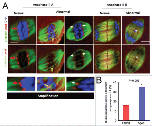 Figure 3. Bi-directional kinetochore attachment persists during oocyte anaphase II. (A) Different states of k-MT attachments and chromosomes during oocyte anaphase II are exhibited. Anaphase II is divided into anaphase II A and anaphase II B. In anaphase II A, kinetochores are attached by polar attachments (red arrow), Normal; some kinetochores are attached by merotelic attachments (white arrow), or one dyad is attached by sister pair bi-directional attachment (yellow arrow), Abnormal. In anaphase II B, no lagging chromosome, Normal; at least one lagging chromosome (white asterisk), Abnormal. Scale bar, 5μm. (B) Kinetochore attached by bipolar spindle microtubules in anaphase II A was quantified in 20 aged and 26 young oocytes. P = 0.005. The data were collected from 6 independent experiments and are shown as means ± SEM.