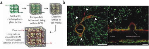 Figure 4. (a) Schematic of the process to produce cell-laden hydrogels with perfusable vascular networks using sacrificial glass fibers. (b) Cross-section of the construct showing vascular network lined with endothelial cells, vessel sprouts and intervessel junctions. Reprinted from reference [Citation75] with permission. Copyright Nature Publishing Group (2012).