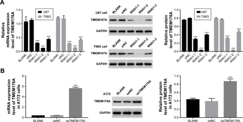 Figure 2 Knockdown and overexpression of TMEM176A in GBM cells.