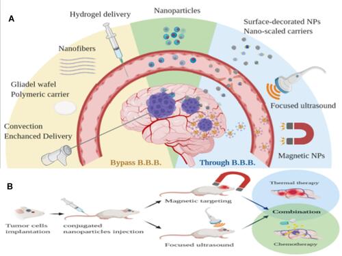 Figure 3 (A) Local delivery system that bypasses the blood–brain barrier (BBB) to reach the brain tumor. (B) NPs crossing the BBB with the aid of FUS and an external magnetic field.