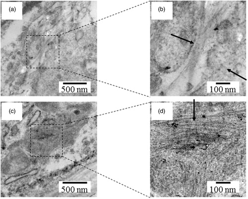 Figure 8. Long (a,b) and short (c,d) SWCNTs (arrows) found in the lung parenchyma. Images (a) and (c) are shown enlarged in (b) and (d), respectively.