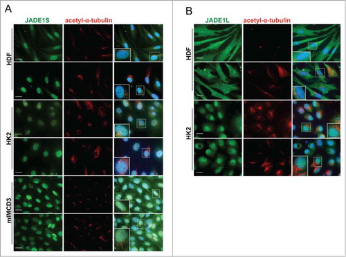 Figure 5. JADE1S and JADE1L are absent from the cilia structures. For robust cilia production HDF and HK2 cells were cultured in 0.1% sera for 48 hours. IMCD3 cells were cultured for 3 d in serum-depleted followed by serum-free media for 16 hours. Cells processed for IF with indicated antibodies. Acetylated-α-tubulin antibody was used to mark cilia. Note that, (A) JADE1S and (B) JADE1L1 do not co-localize with acetylated-α-tubulin. Cells boxed are magnified as inserts. Scale Bars: 20 µm.