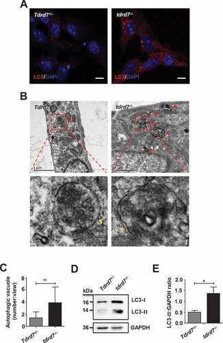 Figure 1. Evaluation of autophagosomes in Tdrd7+/− and tdrd7−/− MEFs. (A) Immunostaining of Tdrd7+/− and tdrd7−/− MEFs for the autophagic marker LC3 (red signal). (B) The accumulation of enlarged electron-light double-membraned structures (red arrows) in tdrd7-deficient MEFs. Some autophagosomes in tdrd7-deficient MEFs were observed as a part of enlarged multi-lamellar structures. Red dotted box: the magnified picture of autophagosomes of which the “double membranes” could be seen faintly (yellow arrows). Scale bar: 1 μm. (C) Quantification of the average number of autophagosomal structures in Tdrd7+/− and tdrd7−/− MEFs using TEM analysis. *P < 0.05. (D) Immunoblotting analysis of LC3 in both Tdrd7+/− and tdrd7−/− MEFs (left). (E) Quantification analysis revealed a significant accumulation of LC3-II (*P < 0.05), GAPDH served as a loading control. Data are representative of three independent assays