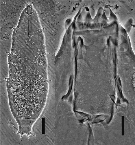 Figure 1 Milnesium shilohae sp. nov. (phase-contrast microscopy). A, Habitus, ventral view, scale bar 100 μm; B, buccal tube, scale bar 10 μm.