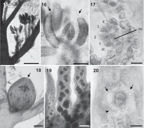 Figs 15–20. Lophurella spp.: reproductive morphology. Fig. 15. Spermatangial branches densely clustered on second-order determinate branches. Fig. 16. Spermatangial branches with one or two sterile apical cells (arrows). Fig. 17. Procarp showing the supporting cell (su), a four-celled carpogonial branch (1–4) and a basal sterile cell (st). Fig. 18. Cystocarp with an apical ostiole (arrow). Fig. 19. Determinate branches with spirally arranged tetrasporangia. Fig. 20. Tetrasporangium with two presporangial (arrows) and a postsporangial (arrowhead) cover cells. Figs 15, 16, L. periclados; Figs 17, 18, 20, L. nigra; Fig. 19, L. mutabilis. Scale bars: Fig. 15 = 300 µm; Figs 16, 18 = 70 µm; Fig. 17 = 10 µm; Fig. 19 = 100 µm; Fig. 20 = 25 µm.