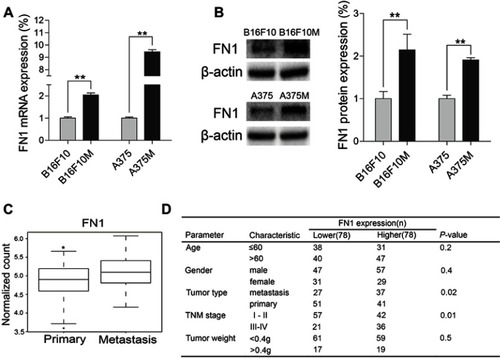 Figure 2 FN1 was upregulated in metastatic melanoma cells compared to primary melanoma cells, and increased expression of FN1 was associated with poor prognosis in SKCM patients. (A) The RT-qPCR result showed that the FN1 transcriptional level was increased in metastatic melanoma cells compared to primary melanoma cells. (B) Western blotting showed FN1 protein expression level was higher in metastatic melanoma cells than in primary melanoma cells. (C) FN1 expression in distant metastatic tumors was higher than that in primary tumors. Statistical significance was derived using Wilcoxon Rank test. The raw data were downloaded from TCGA. (D) The relationship between expression of FN1 and clinical characteristics of skin cutaneous melanoma. The result showed that upregulation of FN1 was positively correlated with advanced stage and metastases. Statistical significance was derived using Chi-square test. Data were presented as mean ± SD. *P<0.05; **P<0.01.Abbreviations: FN1, fibronectin 1; TCGA, The Cancer Genome Atlas; SKCM, Skin Cutaneous Melanoma.