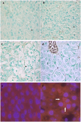 Figure 8. Pictures of TUNEL positive nuclei in the adrenal cortex and medulla and caspase-3 immunofluorescence analysis in G0 and G1.