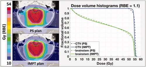 Figure 1. 2D dose distribution and DVH comparison between original (PS) and IMPT plan (MFO, using 3 mm spot size).