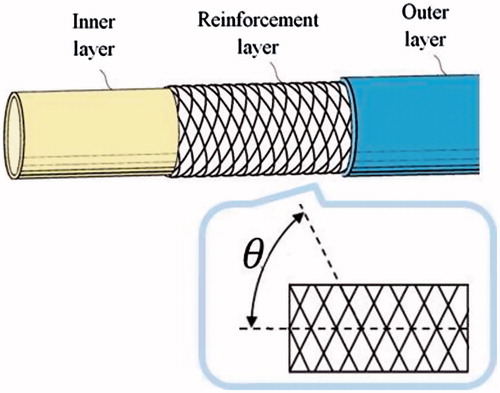 Figure 2. Example of a guiding catheter structure made of three different layers. The reinforcement layer is comprised of a braided mesh characterized by a braid angle that changes the flexibility and torque response of the catheter.