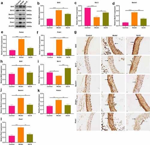 Figure 2. Sal B protects against apoptosis and mitophagy in thoracic aortas of db/db mice. (a–f) Western blot detecting BAX, Bcl-2, Beclin1, Parkin, and Pink1 expression in thoracic aortas of db/m mice, db/db mice as well as db/db mice that were orally administrated 50 mg/kg Sal B for six weeks. (g–l) IHC staining of BAX, Bcl-2, Beclin1, Parkin, and Pink1 expression in thoracic aortas of above mice. Scale bar, 20 μm. *P < 0.05; **p < 0.01; ***p < 0.001; ****p < 0.0001. Arrows indicate the abnormalities as claimed.