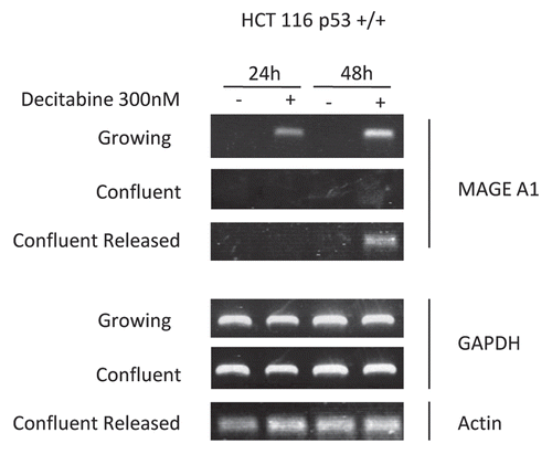 Figure 3 Epigenetic effects of decitabine in HCT 116 cells are cell cycle dependent: MAGE-A1 re-expression is s-phase dependent. Reverse transcription PCR and ethidium bromide detection of MAGE-A1 mRNA expression at 24 and 48 h after a single exposure to 300 nM decitabine in growing, confluent or confluent HCT 116 cells released from arrest. GAPDH and actin were used as procedural controls. Agarose gels shown are representative of three experiments.