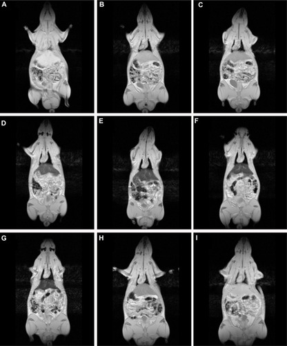 Figure 4 Dynamic magnetic resonance imaging of a rat after injection of SPION microbubbles. Magnetic resonance signal intensity changed mostly in the liver over time from 10 minutes to 6 weeks compared with Pre-injection. (A) Pre-injection and at (B) 10 minutes, (C) one hour, (D) 24 hours, (E) 48 hours, (F) one week, (G) 2 weeks, (H) 4 weeks, and (I) 6 weeks post injection.Abbreviation: SPION, superparamagnetic iron oxide.