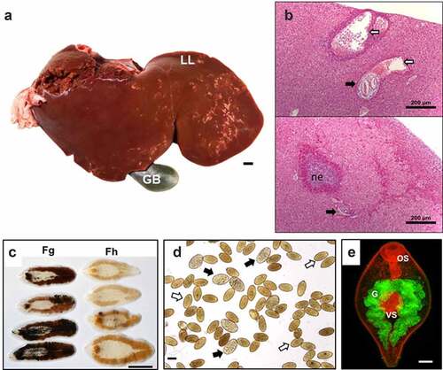 Figure 2. Life stages of F. hepatica and F. gigantica. A: Liver from an infected sheep with acute F. hepatica infection (reported by López Corrales et al. [Citation157]) showing gross pathology. The white tracks delineate the tunneling activity of the parasites through the liver tissues, most commonly observed on the left lobe of liver closest to the intestine in situ (LL). GB: Gall bladder. Scale bar, 1 cm. B: Microscopical liver pathology shown by hematoxylin and eosin (HE) stained serial liver sections from a mouse infected with F. hepatica (Molina-Hernandez and Dalton, unpublished). Top panel: Liver section displaying the migratory tracts (white arrows) formed by the invading F. hepatica immature flukes (black arrow). Bottom panel: The damage caused by the migrating parasite (black arrow) is resolved with no visible tracts in the liver and acute necrotic foci (ne) comprised of inflammatory cells (mainly eosinophils and macrophages). Scale bar, 200 µM. C: Adult F. gigantica (Fg) and F. hepatica (Fh) parasites. Note the typical leaf shape morphology of each species and the size variation. The length-to-width ratio of adult F. gigantica is greater than that of F. hepatica parasites. F. hepatica parasites have a broader anterior end, with defined shoulders, whilst F. gigantica is narrower and lacks this definition. Scale bar, 1 cm. D: The differential morphology of eggs from F. hepatica (white arrows) and F. gigantica (black arrows). The eggs of F. gigantica are typically larger, but variation exists in different definitive hosts and thus a considerable overlap is observed. Scale bar, 100 µM. E: The invasive newly excysted juvenile stage of F. hepatica has a typical cephalic cone shape. Antibodies to the digestive cathepsin peptidase L3 were used to probe the parasite and highlights their bifurcated gut (g) represented by the green fluorescence. The musculature of the parasite is highlighted by the red fluorescence, that accentuates the oral sucker (OS), ventral sucker (VS) and tegument of the parasite. Scale bar, 20 µM