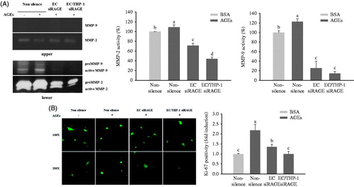 Figure 6. Effects of AGEs on MMP expression and VSMC proliferation. HUVECs and THP-1 cells were co-cultured with VSMCs for 24 h after being transfected with non-silencing control siRNA or RAGE-specific siRNA. They were then treated with BSA or glycol-AGEs (100 μg/mL) for another 24 h. (A) Gelatin zymogram revealing the effects of glycol-AGEs and RAGE knockdown on inducible MMP-2 and MMP-9 activities in conditioned medium from co-cultures with HUVECs and THP-1 cells (upper), VSMCs (lower), the lower compartment was used to perform image analysis. (B) Effects of glycol-AGEs on VSMC proliferation (Ki-67 expression) induced by co-culture with HUVECs and THP-1 cells. The cells were stained with primary Ki-67 antibody and Alexa fluor® conjugated (green) secondary antibody. Magnification: 100 × (top), 200 × (bottom). Lower panels, statistical analysis of Ki-67 cell positivity as fold induction compared to the BSA-treated non-silenced control group. Each value represents the mean ± S.D. of three independent determinations. EC siRAGE, knock-down RAGE in HUVECs; EC/THP-1 siRAGE, knock-down RAGE in both HUVECs and THP-1 cells. Bars with different letters (a, b, c, and d) differ significantly from each other (p < .05).