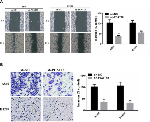 Figure 3 PCAT18 silence inhibited migration and invasion of NSCLC cells. (A) Wound healing assay was performed to determine cell migration. (B) Transwell assay was performed to determine cell invasion. **p < 0.01.