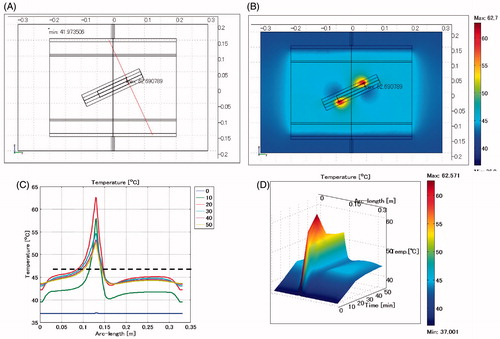 Figure 12. Oesophageal stent. Difference of levels: 4 cm. Lumen: air. (A) Cross-sectional view of the model at x = 0 cm. (B) Temperature distribution after heating for 20 min. (C) Temperature profile on the red line shown in Figure 12A. (D) Extrusion plot of temperature distribution on the red line shown in Figure 12A. Maximum SAR 2678 W/kg, maximum temperature 62.7 °C.