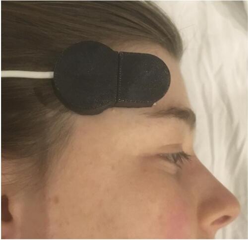 Figure 1 The brain oximeter sensor on the right forehead of a subject.