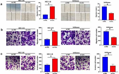 Figure 4. Hsa_circ_0039569 mediated the migration and invasion of endometrial carcinoma cells. Hsa_circ_0039569 was overexpressed in HEC-1-B cells and knocked down in Ishikawa cells. (a and b) Cell migratory ability was assessed by wound healing (a) and Transwell (b) assays. (c) Cell invasive ability was assessed by Transwell assay. * denoted P < 0.05.