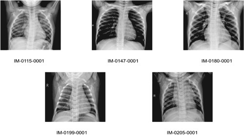 Figure 14. Experimental outcome of JPEG compression attacks.