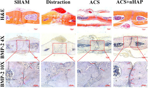 Figure 5 Histochemical staining of sagittal suture tissues from different groups. H&E staining of sagittal sutures (top panel; scale bar, 100 μm). In ACS+nHAP group, the bone microarchitecture developed in a more balanced morphology with homogeneous expansion than distraction group. Immunohistochemistry staining of BMP-2 on sagittal suture tissues (middle and bottom panels) shows that the number of osteoblasts (stained in brown) is more abundant and distributed more homogeneously in the sutures in the ACS+nHAP group than in the other groups. Red arrows indicate osteoblasts. Scale bar, 100 μm.