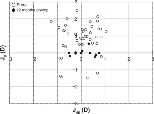 Figure 5 Scatter plot of the astigmatic vectors (J0 and J45) before and 12 months after toric implantable collamer lens implantation. The more central location of postoperative data around 0 represents the reduction of preoperative astigmatism by the implantation of the toric implantable collamer lens. Note that (0,0) represents an eye free of astigmatism.