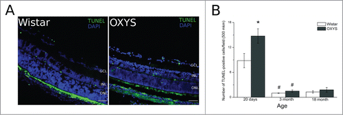 Figure 1. Apoptotic activity was analyzed by the terminal deoxynucleotidyl transferase-mediated deoxyuridine triphosphate nick end labeling (TUNEL) assay. (A) Positive TUNEL straining (green) was observed under a fluorescence microscope. (B) Quantitative analysis. The number of apoptotic cells was calculated by averaging the number of positive TUNEL signals. *Significant interstrain differences, р < 0.05; #significant differences with the preceding age, р < 0.05. Bar 50 mkm.