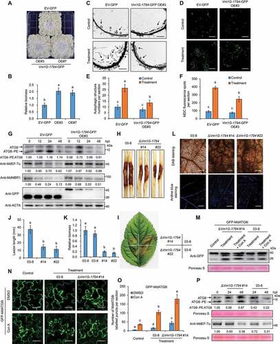 Figure 7. Vm1G-1794 is a virulence effector and counteracts the resistance against V. Mali conferred by MdATG8i-mediated autophagy. (A) Representative disease symptoms in transgenic calli overexpressing Vm1G-1794-GFP (OE#3 and OE#7) and infected with V. Mali; photographs were taken at 3 d. Overexpression of GFP empty vector was used as a control. (B) Relative fungal biomass of V. Mali in infected calli described in (A). (C) Representative transmission electron microscope (TEM) images of autophagic structures in transgenic calli of EV-GFP and Vm1G-1794-GFP OE#3 at 24 h post-treatment under control or treatment conditions. Arrowheads indicate the ultrastructure of autophagic bodies inside the vacuoles. Scale bar: 2 μm. (D) MDC-stained autophagosomes in the transgenic calli of EV-GFP and Vm1G-1794-GFP OE#3 at 24 h post-treatment under control or treatment conditions. Scale bars: 20 μm. (E and F) Quantification analysis of the numbers of autophagic structure and punctate MDC-stained spots per section described in (C and D) with at least 10 individual images acquired from different leaf areas. (G) ATG8 protein levels and stability of MdEF-Tu and MdNBR1 in calli overexpressing Vm1G-1794-GFP OE#3 or GFP empty vector upon V. Mali infection. Actin protein was used as the internal control. (H and I) Representative disease symptoms of detached stems and leaves in GL-3 infected with V. Mali WT strain 03–8 or Vm1G-1794 deletion mutant (#14 and #22) and photographed at 7 d and 3 d, respectively. (J and K) Statistical analysis of the length of the necrotic regions of stems in (H) and relative fungal biomass of diseased leaves in (I) based on three independent biological replicates with at least 15 infected leaves or stems per replicate. (L) ROS accumulation and callose deposition in GL-3 leaves infected with V. Mali WT strain 03–8 or Vm1G-1794 deletion mutant were detected by DAB and aniline blue staining. Bars: 500 μm. (M) Immunoblot analysis of the processing of GFP-MdATG8i in apple leaves infected with V. Mali WT strain 03–8 or Vm1G-1794 #14 deletion mutant with or without Con A treatment. Sterile PDA medium was used as a control. (N) Confocal microscopy analysis of the number of GFP-MdATG8i-labeled puncta in apple leaves infected with V. Mali WT strain 03–8 or Vm1G-1794 #14 deletion mutant with or without Con A treatment. Maximum projections of images represent independent Z-stacks with 30 individual images each. Scale bars: 50 μm. (O) Quantification analysis of the numbers of MdATG8i labeled puncta per section described in (N) with at least 10 individual images acquired from different leaf areas. (P) Stability of ATG8 and MdEF-Tu protein levels in GL-3 leaves infected with V. Mali WT strain 03–8 or Vm1G-1794 #14 deletion mutant. Ponceau S staining is shown as a loading control.