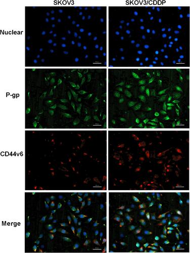 Figure 7 Immunofluorescence co-localization to detect the expression of CD44v6 and P-gp. Blue represent Nuclear, Green represent P-gp, Red represent CD44v6.