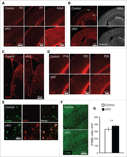Figure 2. Prenatal deletion of Dnmt1 increases expression of GFAP in astrocytes (A) Representative immunofluorescence images of GFAP (red) in the cortex of coronal brain sections from control and cKO mice at various time points. (B) GFAP immunostaining images (red, left panels) of representative cortical neurons in coronal adult brain sections from control and cKO mice. The nucleus was stained with Hoechst (gray, right panels). Ctx: cortex. (C) GFAP immunostaining images (red) of representative regions including the SVZ in coronal adult brain sections from control and cKO mice. (D) Representative GFAP immunofluorescence images (red) of cortical neurons in coronal brain sections from control and cKO mice at various time points. (E) GFAP (red) and S100β (green) immunostaining images of representative cortical astrocytes in coronal brain sections from adult control and cKO mice. (F) Representative image of staining for S100β (green) in the cortex of coronal brain sections from adult control and cKO mice. (G) Quantification of S100β+ cells in the cortex in (F). (Control = 3, cKO = 3). Scale bars are indicated in each figure. Values represent mean ± SEM; n.s > 0.05. Student's t-test. GFAP: glial fibrillary acidic protein.