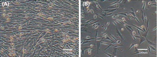 Figure 2. Skeletal muscle satellite cells before freezing and after recovery. A. Before freezing; B. After recovery.