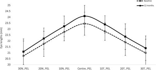 Figure 1 Peripheral eye length (PEL) at the baseline and 12 months in single vision (SVS) wearers.
