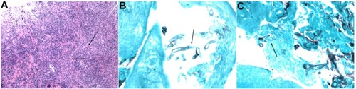 Figure 3 Histopathology slides.