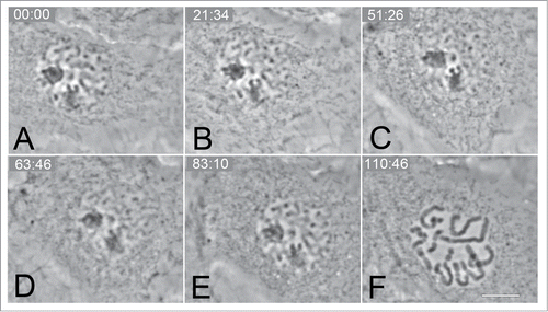Figure 4. Selected frames from a time-lapse series of CFPAC-1 cell showing a reversal of mitosis (A–C) in response to mild hypothermia (20°C). The chromatin can be clearly seen decondensing to an “interphase” appearance (C). Normal progression of mitosis can be seen (D–F) including nuclear envelope break (F) down once the temperature was returned to 37°C. Bar = 10 μm.