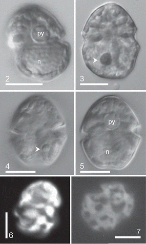 Figs 2–7. Heterocapsa claromecoensis sp. nov. LM. Figs 2, 3, 6, 7. Strain LPCc-005; Figs 4, 5. Strain Arg-B5. Figs 2–5. Live cells or Lugol’s preserved cells observed in brightfield. Figs 2, 5. Note one pyrenoid (py) in the episomes and a large, ellipsoidal nucleus (n) in the hyposomes. Figs 3, 4. Note the small red accumulation body (arrowhead). Figs 6, 7. Cells observed with epifluorescence. Note the reticulate chloroplasts. Scale bars = 10 µm (Figs 2–7)