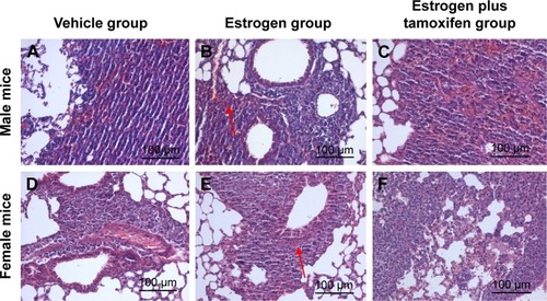 Figure 4 The images of H&E staining for lung tissue; 400× magnification.