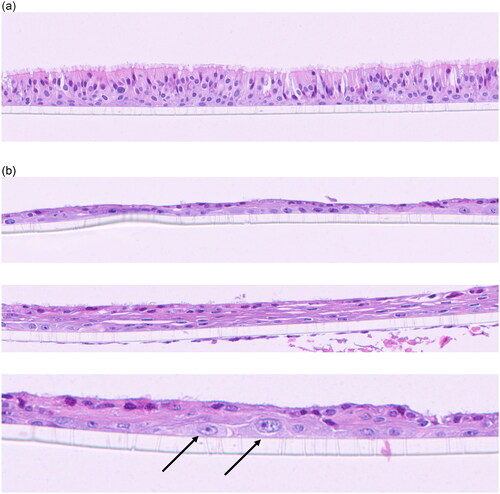 Figure 2. (a). 15-day incubator control. Well-defined pseudostratified ciliated epithelium with goblet cells and underlying basal cells. (b) 15-day mock treatment (air only) control. The respiratory epithelium in the upper panel is thinner (one layer in this image) and the nuclei are darker and more flattened indicative of squamous metaplasia. The dark eosinophilic surface is indicative of keratin production. Basal cells are present adjacent to the scaffold and appear reactive. The Middle panel has more layers of squamous epithelial cells with keratin production and scattered ciliated cells. The lower panel (20+ magnification) illustrates reactive basal cells (arrows) that are larger with paler chromatin and prominent nucleoli.