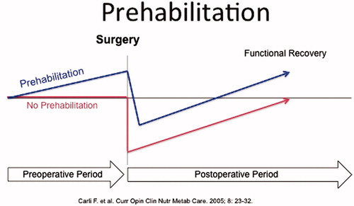 Figure 1. Trajectory of the perioperative period and impact of increasing functional reserve in the preoperative period (prehabilitation) on accelerating the postoperative functional recovery.