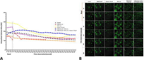 Figure 6 PRF decreases intracellular Ca2+ intensity in sensitized DRG neurons. (A) Sensitized neuronal experienced a significant increase in intracellular Ca2+ intensity at the initial time of observation compared to basal level (red). In sensitized neurons exposed to PRF, there was an increase in intracellular Ca2+ intensity, but not significantly compared to basal intensity (blue). (B) Fluorescent imaging show intracellular Ca2+ influx in basal and treatment. Description: Superimpose (SI): description of the combined observations of intracellular calcium and DIC (differential interference contrast) observations. Magnification: 400X.