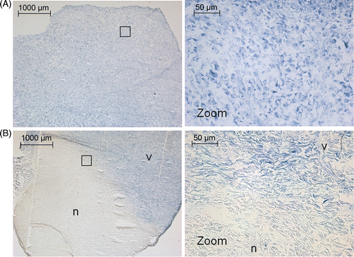 Figure 8. NADH‐diaphorase staining after (A) tumour hyperthermia and (B) tumour ablation. In the hyperthermia experiments, all tissue is viable. In the ablation experiments a clearly defined area of non‐viable tissue is visible. The black box indicates the areas from which the high magnification images were taken. v, viable tissue; n, non‐viable tissue.
