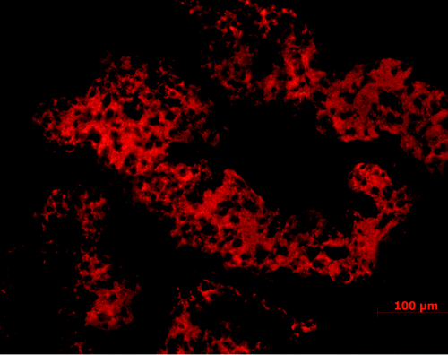 Figure 2. Large accumulation of T. b. brucei (red) in the choroid plexus following intra-peritoneal injection in a rodent model. Choroid plexus loaded with trypanosomes is seen already one week after the infection and before trypanosome crossing of the BBB, of which timing and prevalence is dependent on the rodent strain.