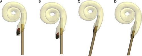 Figure 10. Examples of small and large cochlea with equal intra-cochlear sheaths lengths positioned with cochleostomy (A, B) or round window (C, D) insertion points and trajectories showing the final distal sheath location for each.