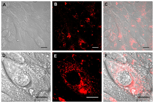 Figure S2 Real time confocal laser scanner microscopy images of Calu-3 cells exposed to Rhod-PLGA/CS nanoparticles for 24 hours and subsequent washing of the medium. (A) Nomarski image, (B) fluorescent image, and (C) superimposition of Nomarski and fluorescence images. (D, E, and F) show enlarged pictures.Note: Scale bars = 20 μm.Abbreviations: Rhod, rhodamine B; PLGA, poly (lactide-co-glycolide); CS, chitosan.