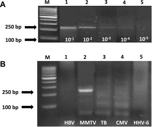 Figure 1 Sensitivity and specificity of PCR assay for detection of MMTV DNA-like env sequences extracted from MCF-7 cell line. (A) Ethidium bromide–stained gel electrophoresis shows sensitivity assay of primers used to amplify MMTV DNA-like env sequences. Positive signals are 250 bp. Lane M = 100-bp ladder; lanes 1–5 = positive lanes of serial dilutions from 10−1-10−5. (B) Ethidium bromide–stained gel electrophoresis of specificity assay of primers used to amplify MMTV DNA-like env sequences. Positive signal at 250 bp. For MMTV DNA product (lane 2), lanes 1, 3, 4, 5 are negatives, Lane M = 100bp ladder.