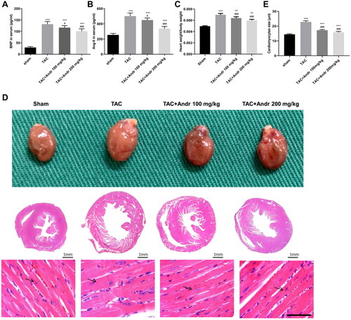 Figure 2. Andr inhibits cardiac hypertrophy in TAC mice. Serum levels of (A) brain natriuretic peptide (BNP) and (B) angiotensin II (Ang II) were determined by ELISA assay. (C) The heart weight to body weight ratios of mice in different groups. (D) Representative images of gross hearts (first panel) and H&E staining of hearts at scale bar = 1 mm (second panel) and scale bar = 50 μm (third panel) from each group of mice. (E) Quantification of cardiomyocyte size of the indicated groups. **p < 0.01 and ***p < 0.001 vs. the sham group; #p < 0.05 and ###p < 0.001 vs. the TAC group.